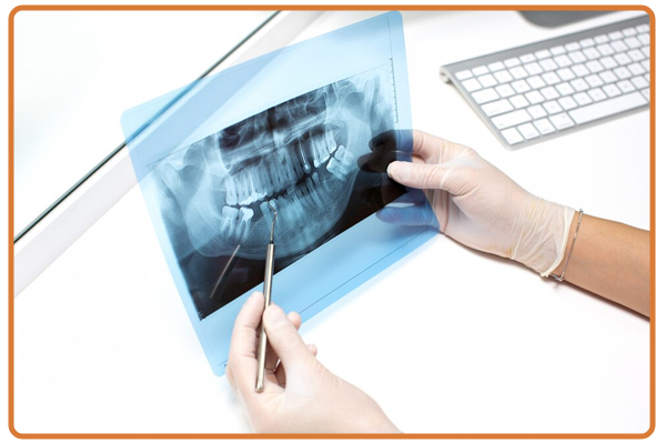 Dental X Rays