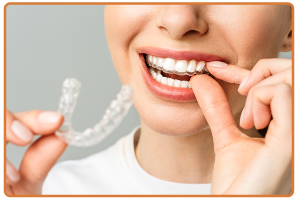 Aligners and Braces