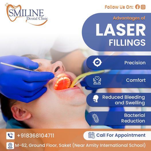 Laser Fillings treatment